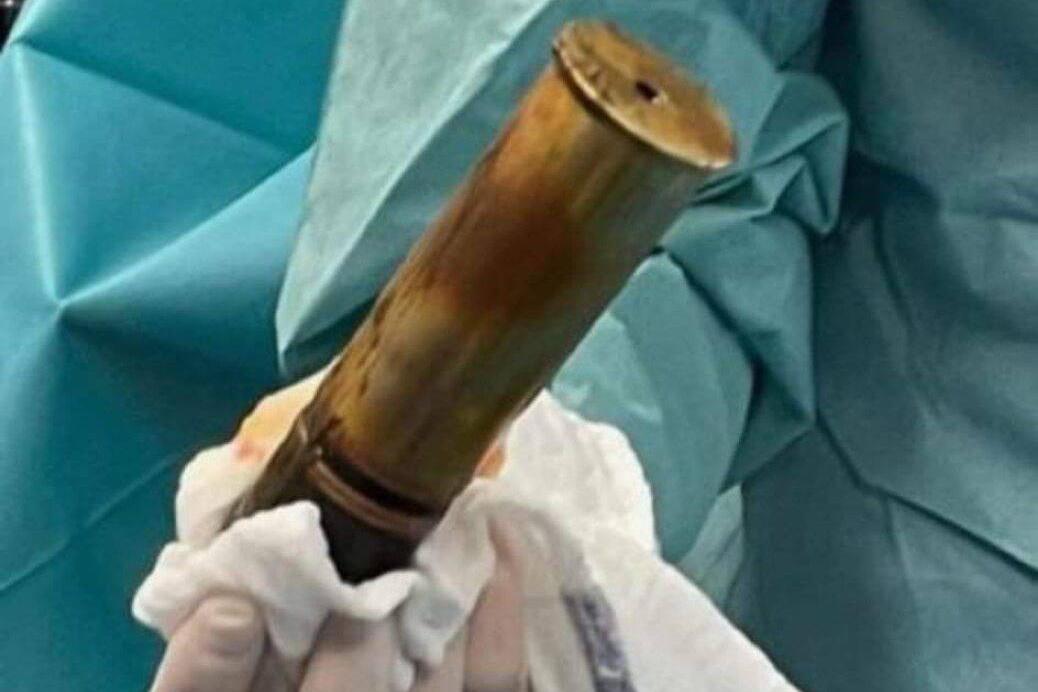 Aux urgence avec un obus dans le rectum…